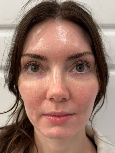 Face