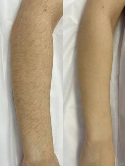 Arms