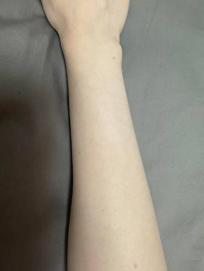 Arms